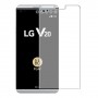 LG V20 Protector de pantalla Hidrogel Transparente (Silicona) 1 unidad Screen Mobile