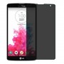 LG G Vista Protector de pantalla Hydrogel Privacy (Silicona) One Unit Screen Mobile